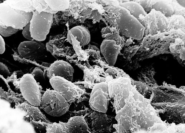 Illustration of Yersinia pestis